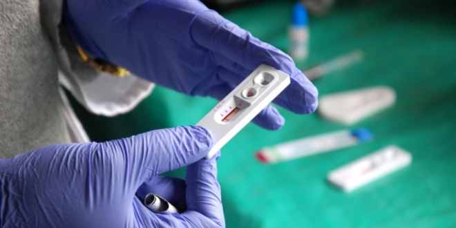 pruebas rapidas VIH Sida